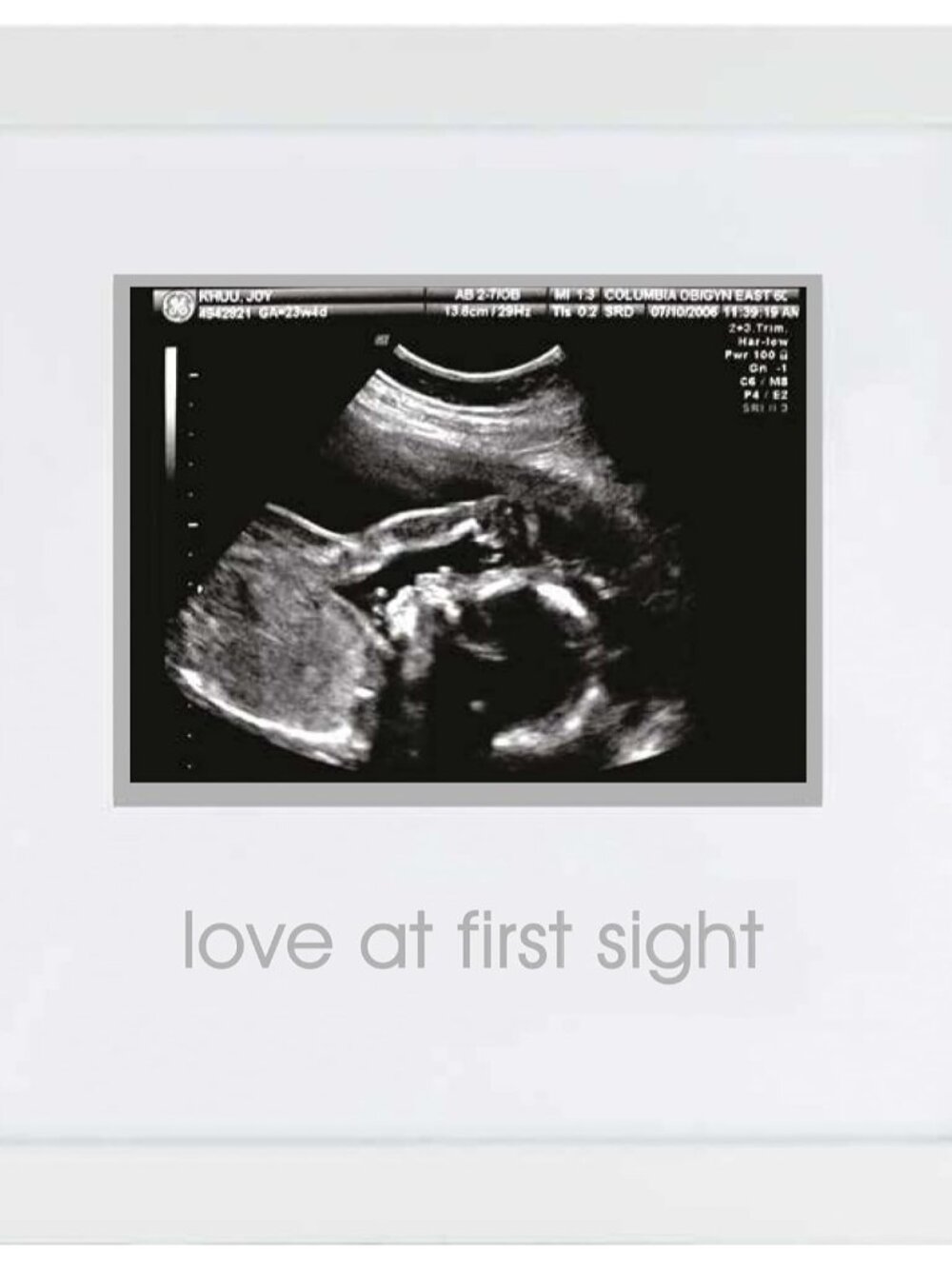 Love At First Sight Sonogram Picture Frame, White